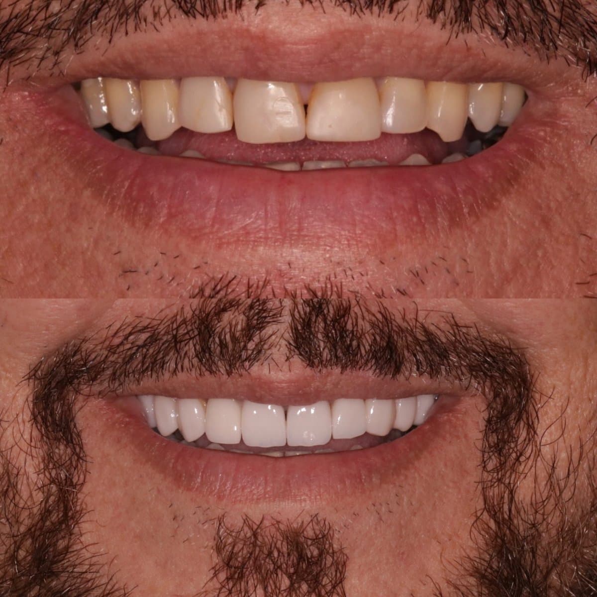Antes e depois, Reabilitação estética